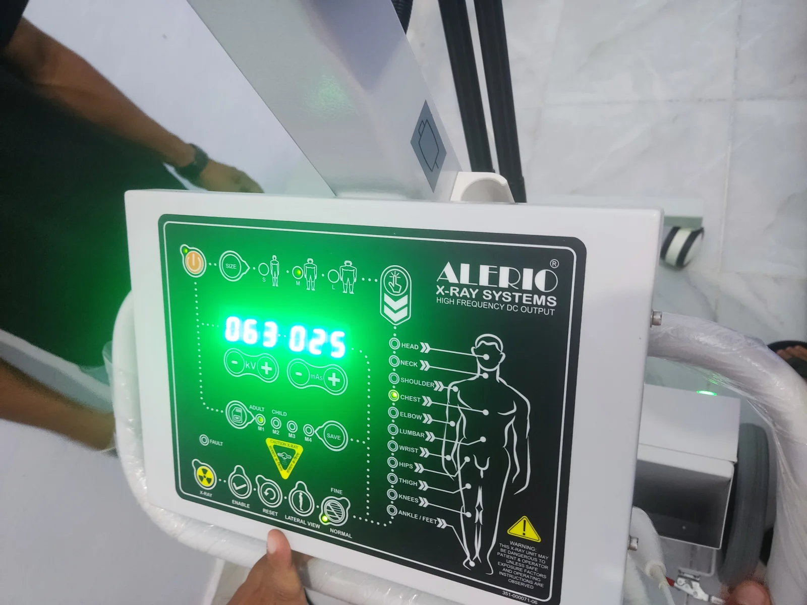 Instalasi DR dan Mobile X-ray Alerio